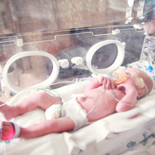 NICU حديثي الولادة و الخداج NICU